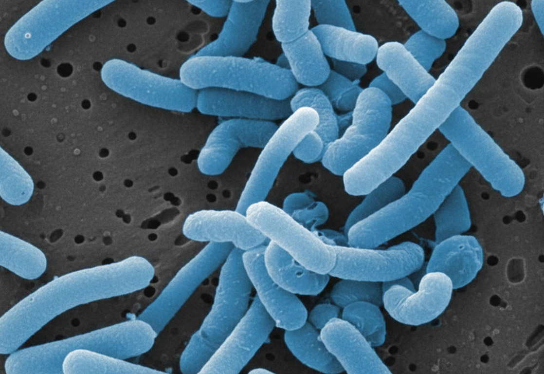 Lactobacillus Paracasei